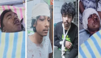 গাজীপুরে মোজাম্মেলের বাড়িতে আহত ৫ জন ঢাকা মেডিকেলে